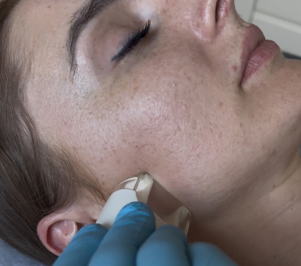 NOWOŚĆ Endermolift Glow